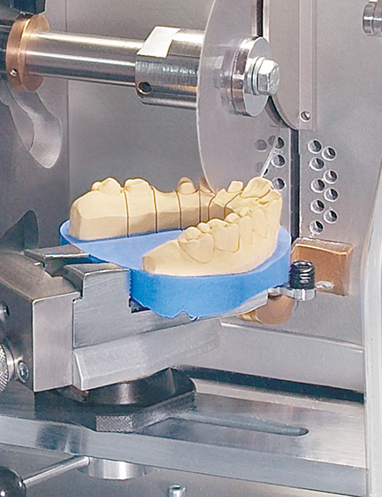 Pin-Modell auf Gipssockel Pin-Modell auf Gipssockel